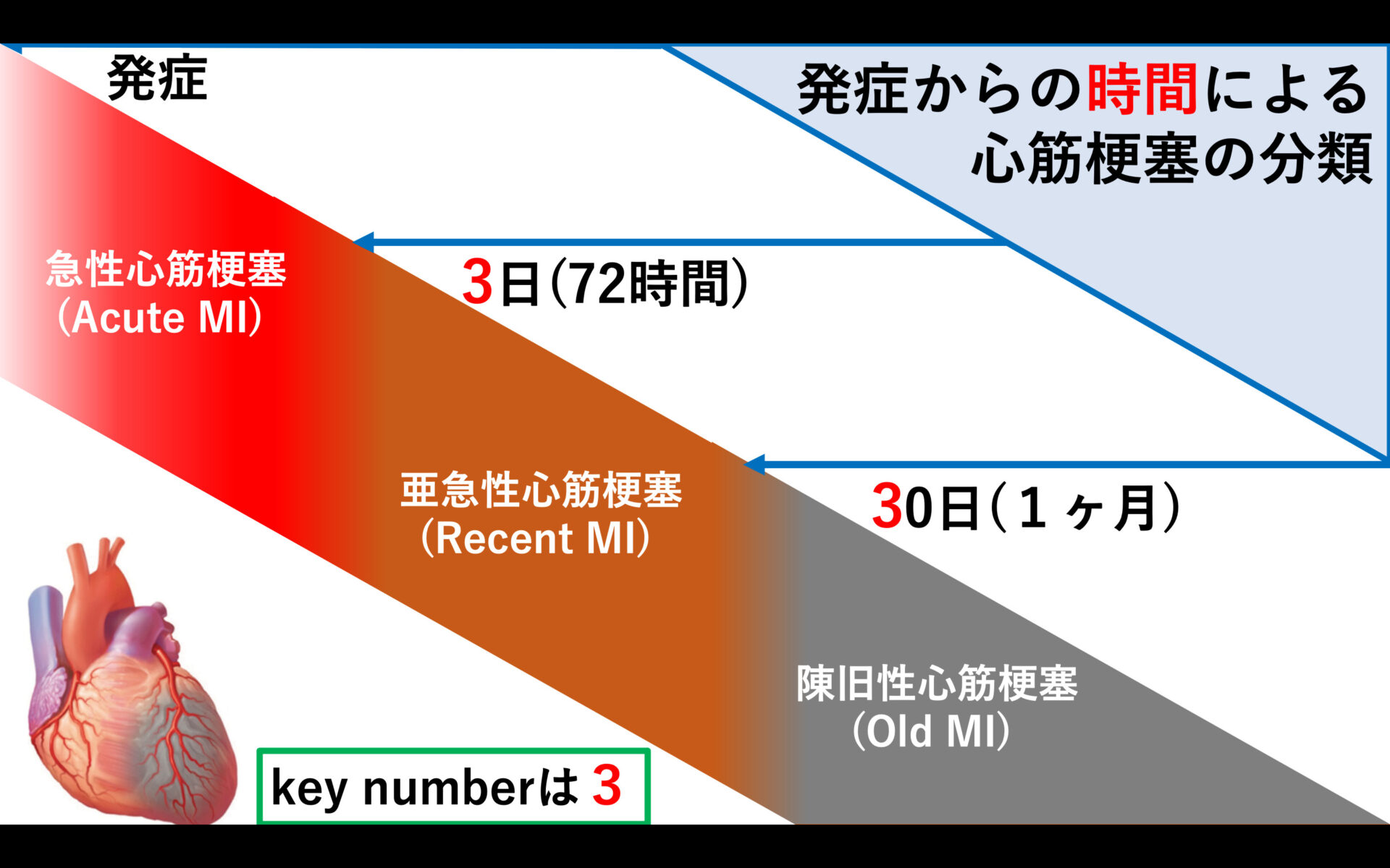 心筋梗塞の時間分類