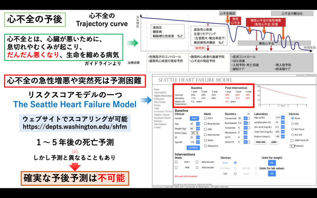 心不全の予後