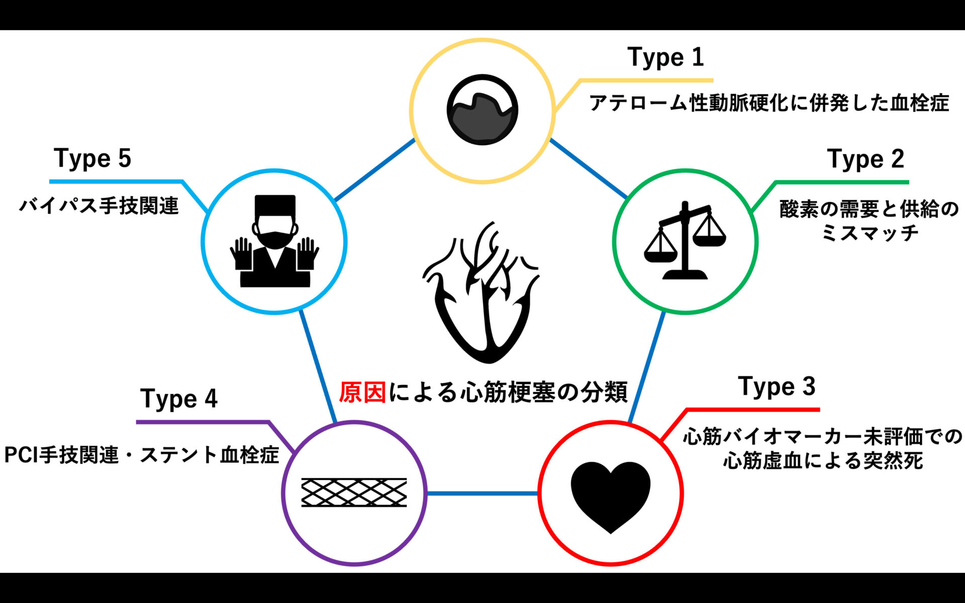 心筋梗塞の原因と分類