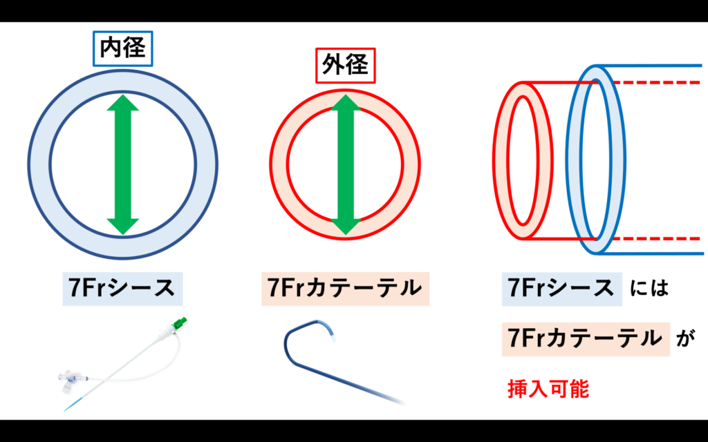 カテーテルとシースのFr